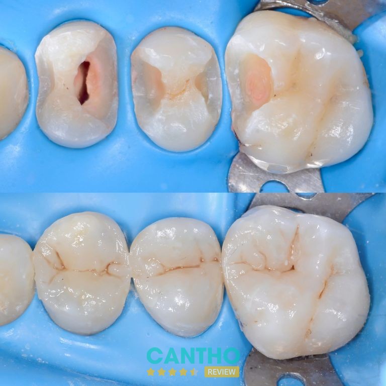 Nha Khoa Cần Thơ NEW – hình ảnh phòng nha