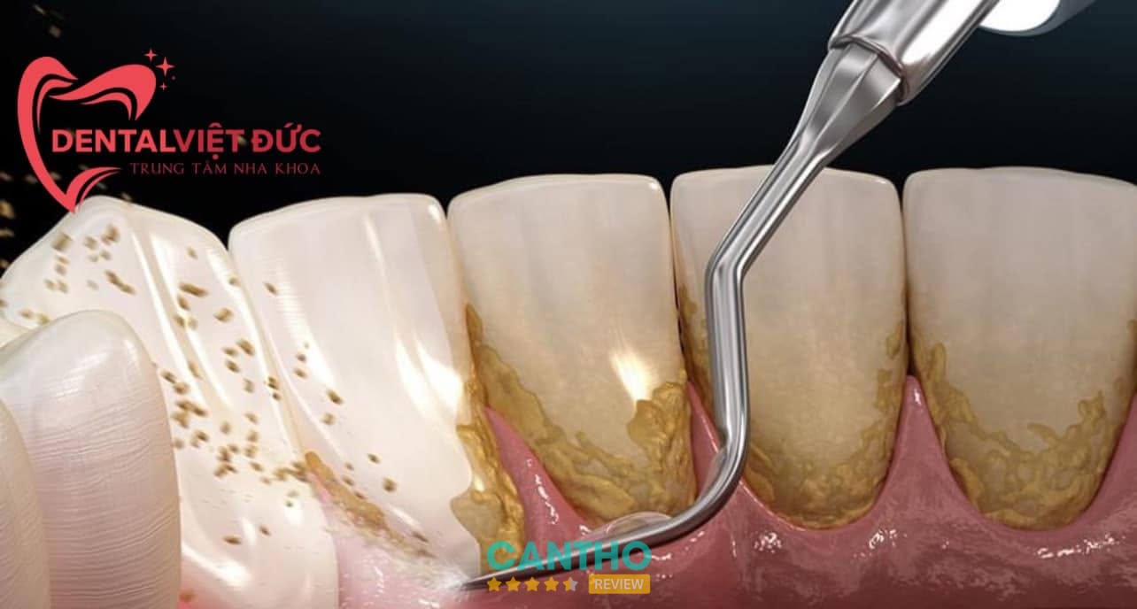 Nha Khoa Việt Đức Ngã Bảy