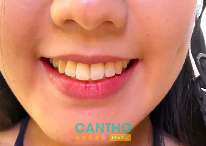 Nha Khoa Phước Trung – hình 2