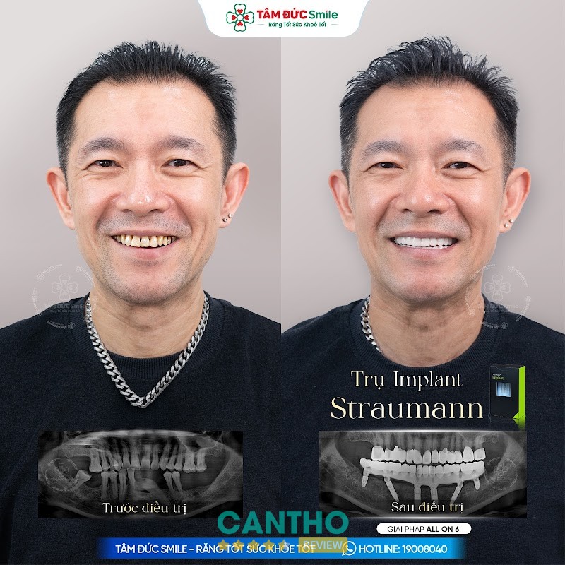 Nha Khoa Tâm Đức Smile 2 – hình ảnh 3