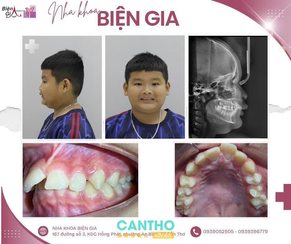 Nha Khoa Biện Gia – hình ảnh 2