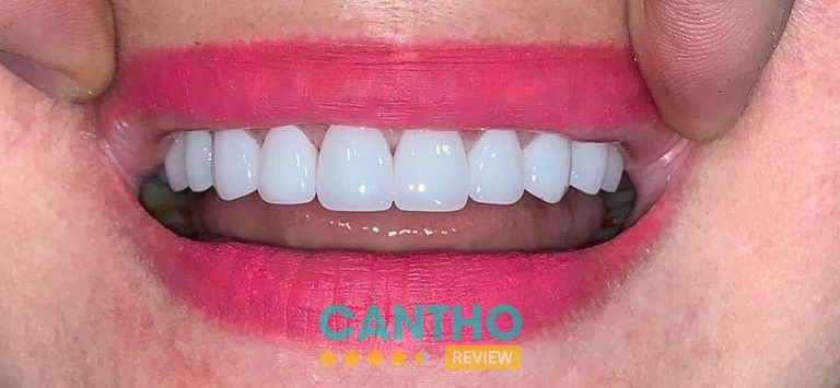 Nha Khoa Phụng Hiệp Ngã Bảy - hình ảnh cơ sở nha khoa 3