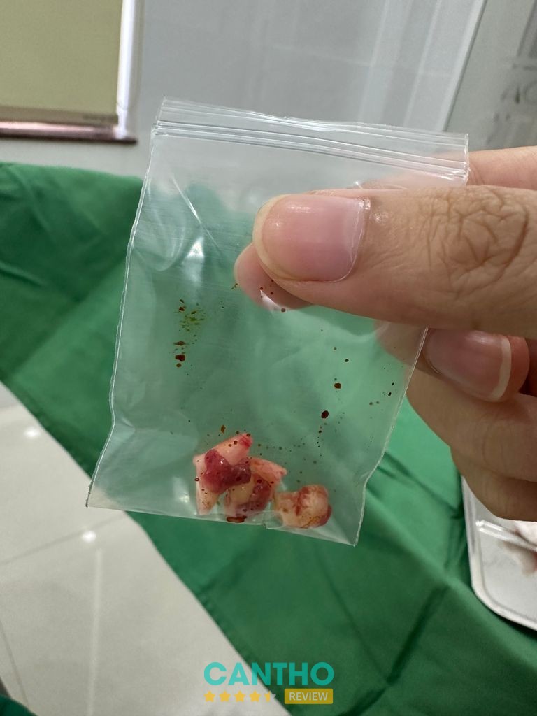 Nha Khoa ODONTO trên đường Nguyễn Văn Cừ Tân An Cần Thơ