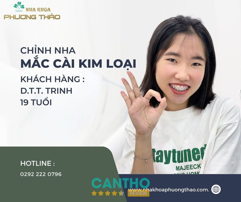 Nha Khoa Phương Thảo Cần Thơ – hình ảnh bổ sung từ Facebook