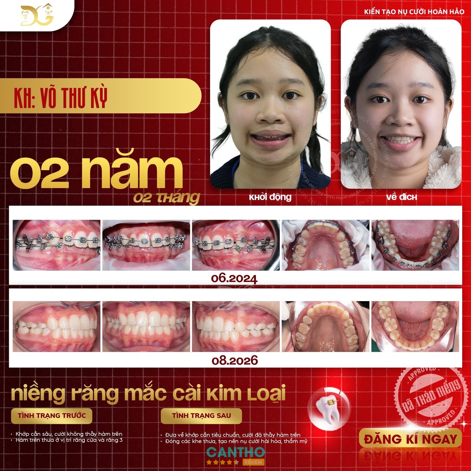 Nha Khoa Ngọc Ngân Luxury Cái Răng