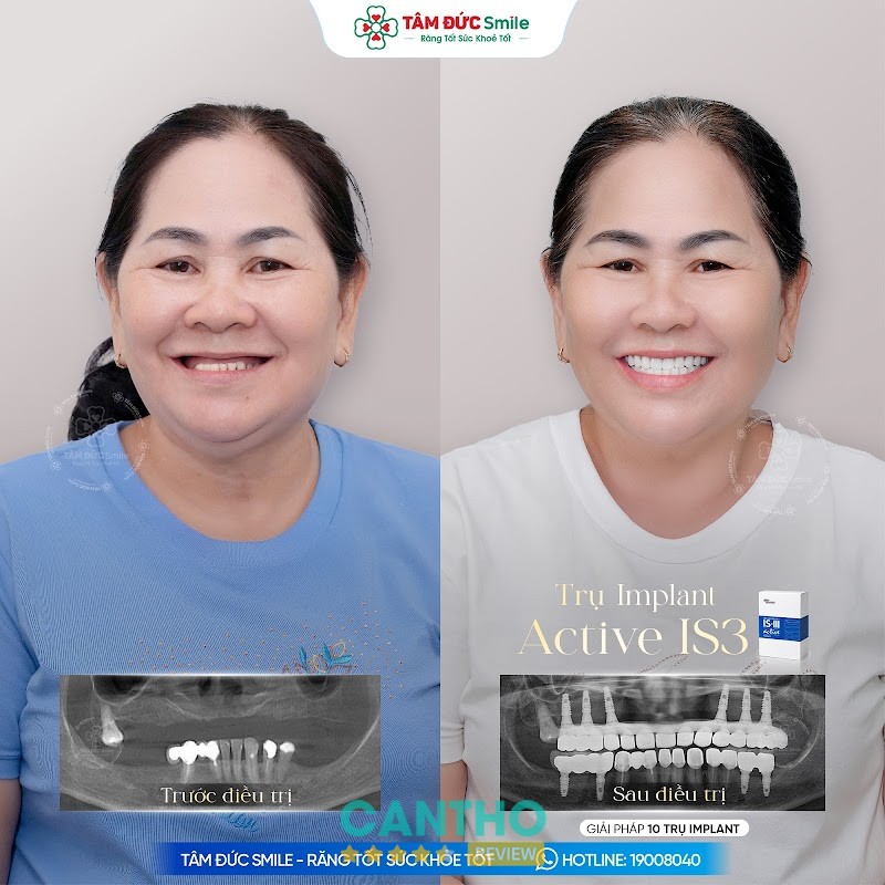 Nha Khoa Tâm Đức Smile 2 – hình ảnh 2