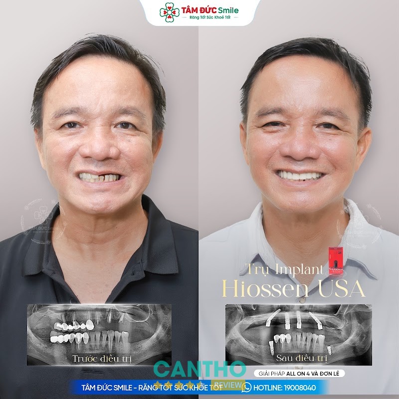 Nha Khoa Tâm Đức Smile 2 – hình ảnh 3