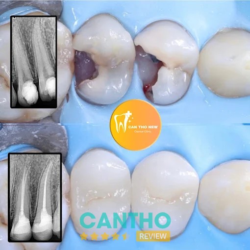Nha Khoa Cần Thơ NEW tại Cái Răng