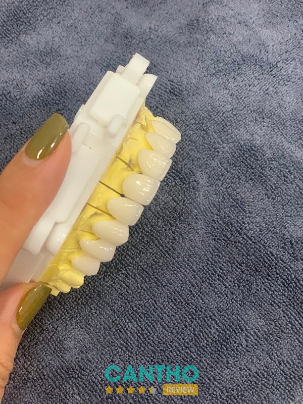 Khu vực điều trị tại Nha khoa Phú Mỹ Sóc Trăng – hình ảnh 3