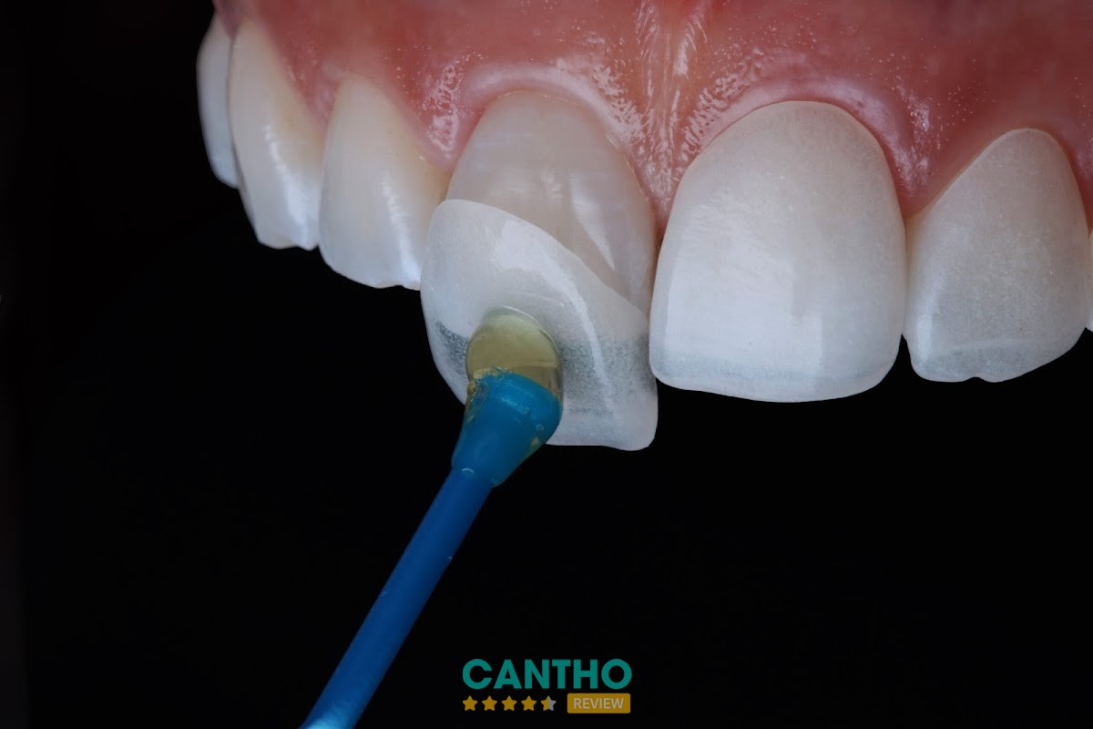 Nha Khoa Thẩm Mỹ ST Dentist Cần Thơ – hình ảnh 2