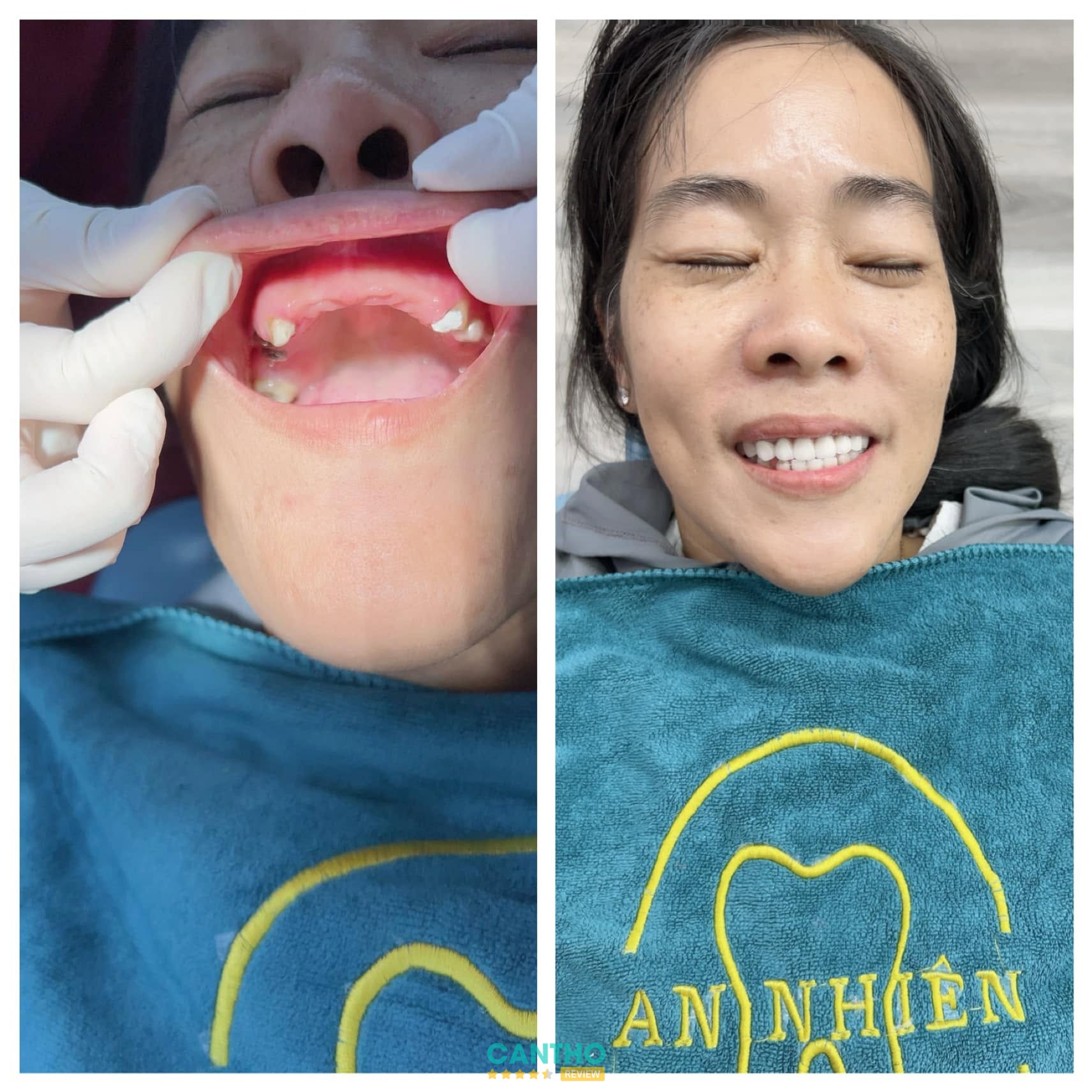 Nha Khoa An Nhiên Tân An