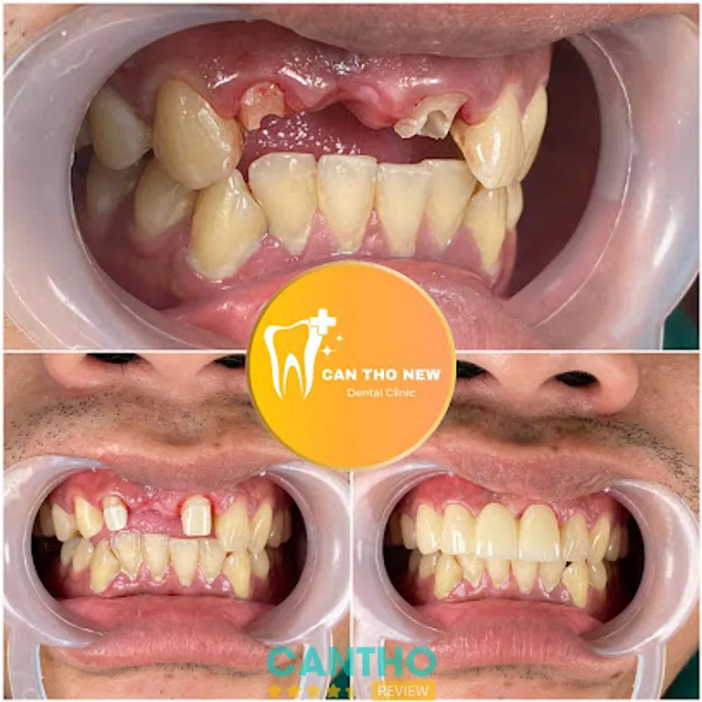 Nha khoa Cần Thơ NEW: 44 Lê Trọng Tấn, P. Cái Răng