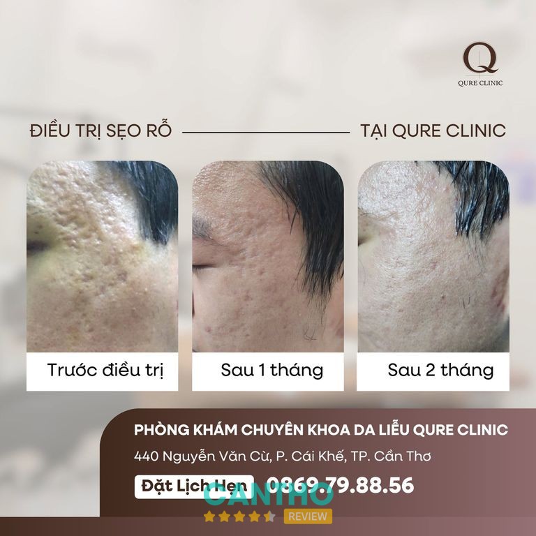 Phòng Khám Da Liễu QURE CLINIC - ThS. BSNT Lệ Quyên – hình 2