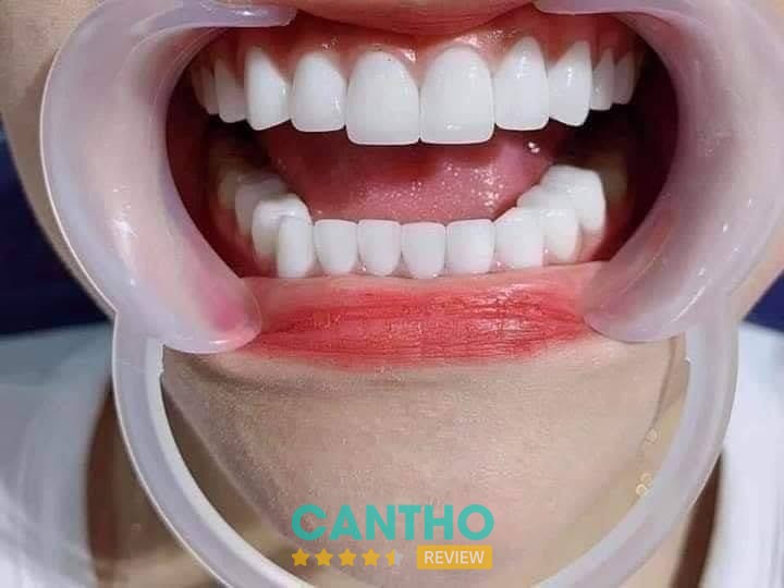 Hình ảnh Phòng Khám Nha Khoa Việt Thái