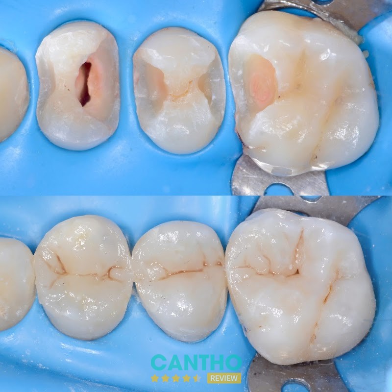 Nha Khoa Cần Thơ NEW – hình ảnh 2