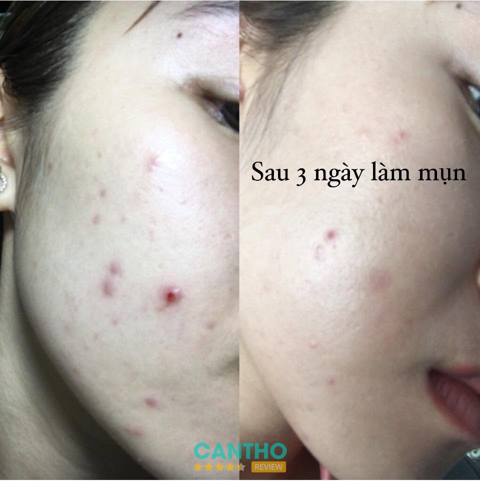 Spa Beauty KP – hình ảnh 2