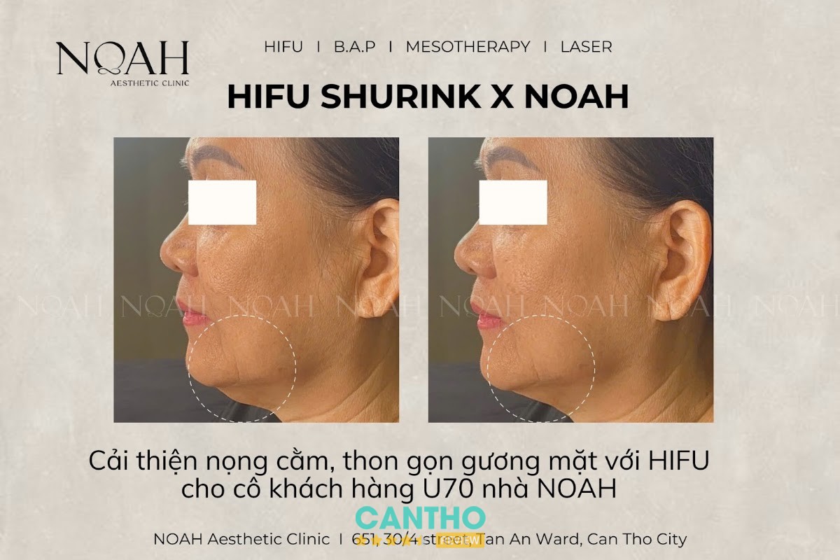 Viện thẩm mỹ NOAH Cần Thơ